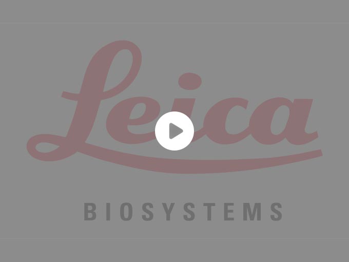 BOND-III Fully Automated IHC and ISH Staining System