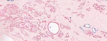 Multiplex Staining 3-Plex