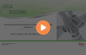 immunohistochemical-analysis-of-selected-head-and-neck-neoplasms-640x410