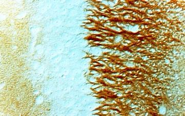 CA 3 field of rat hippocampus. Syn. positive axon terminals over pyramidal cells.