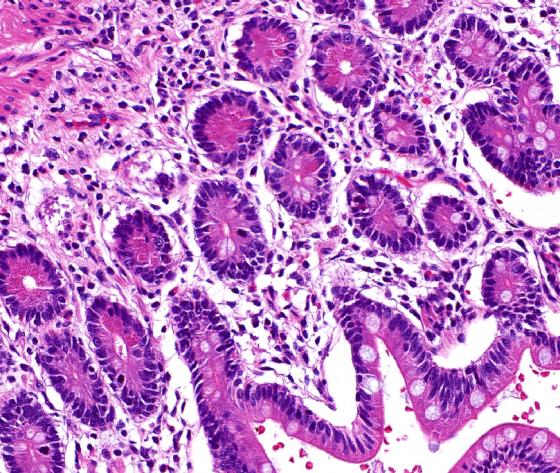 Colon-20x-for-webpage