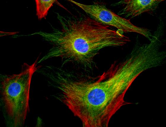 FL-cell-line-63x-for-web-page