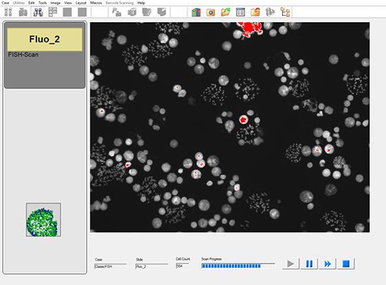 CytoVision-DX-FLMet-InterScan20x