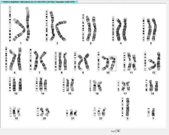 CytoVision-DX-Karyo-1-ideos