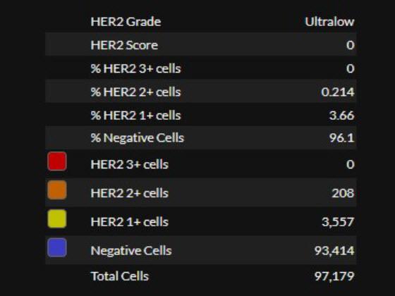 Breast HER2 AI quantitative results 