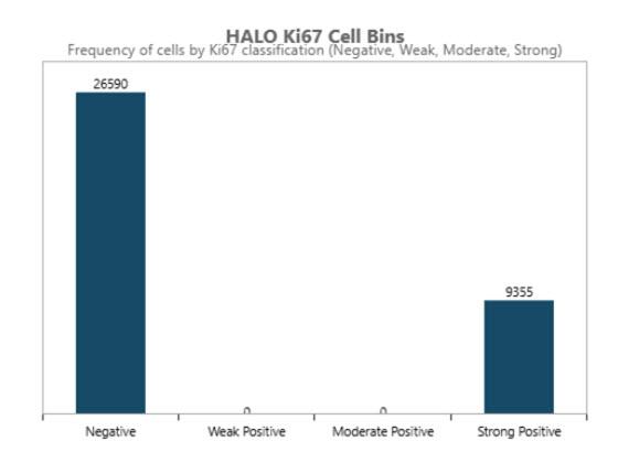 Breast Ki67 AI histogram