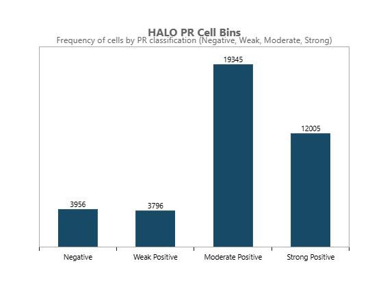 Breast PR AI histogram 