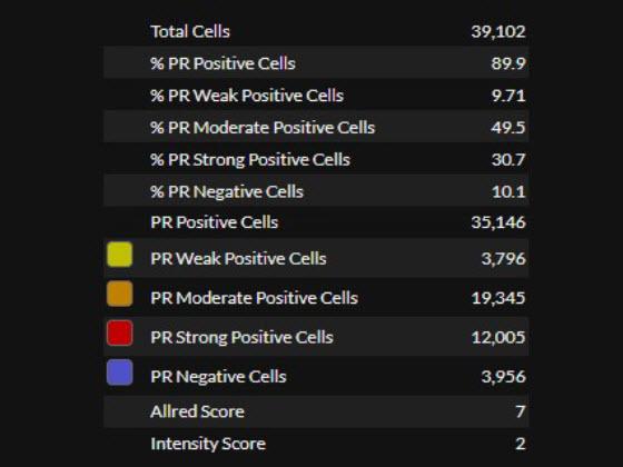 Breast PR AI quantitative results 