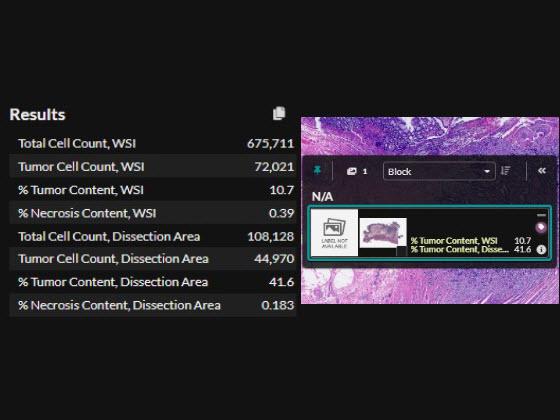 CRC Macrodissect AI quantitative slide results
