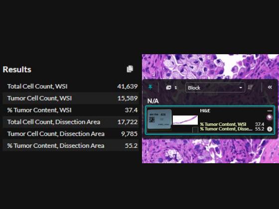 Lung Macrodissect AI quantitative slide results