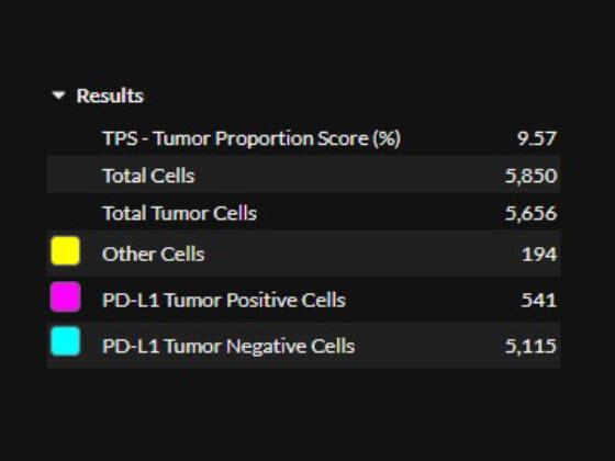 Lung PD-L1 AI quantitative slide results   