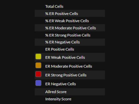 Breast ER AI quantitative results