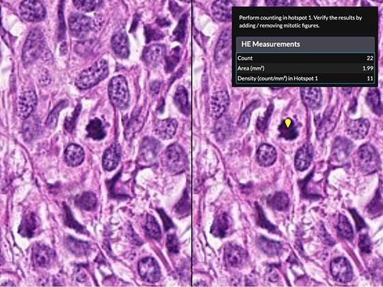 Step 3: Mitotic figure verification