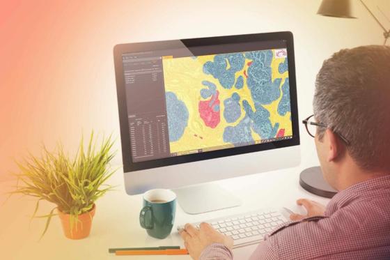 HALO AI | Train-by-Example Analysis Software