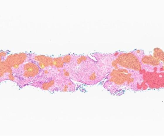 DeepDx Prostate (RUO)