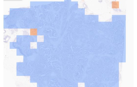 Visualization of PD-L1 expression on the cutoff map