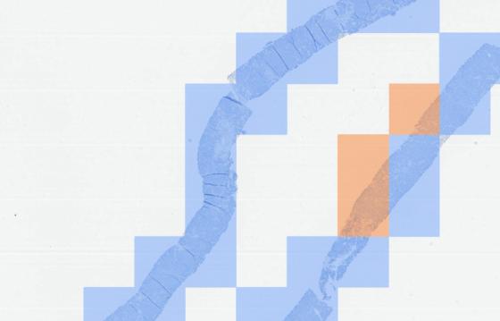 Visualization of PD-L1 expression on the cutoff map