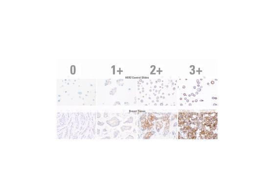 HER2 Control Slides and Tissue Staining