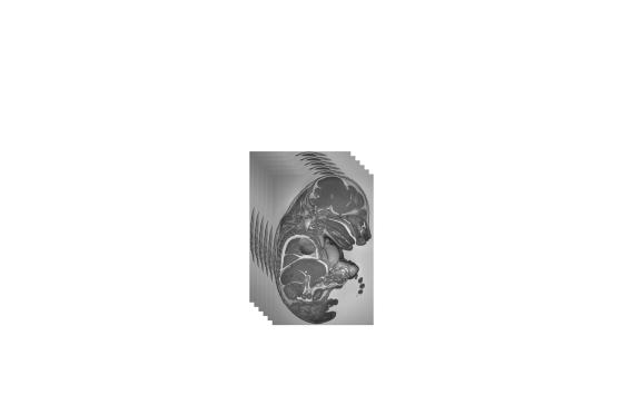 Stacking Technique for 3D Reconstruction