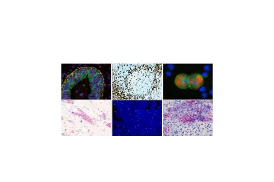 ideal for ihc ish and emerging tests staining