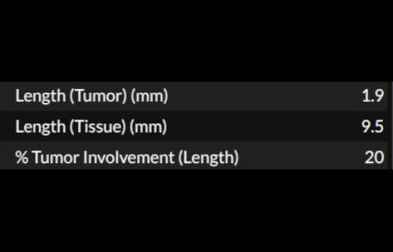 DeepDx Prostate ivd feature3