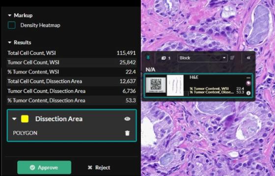 Prostate Macrodissect AI results