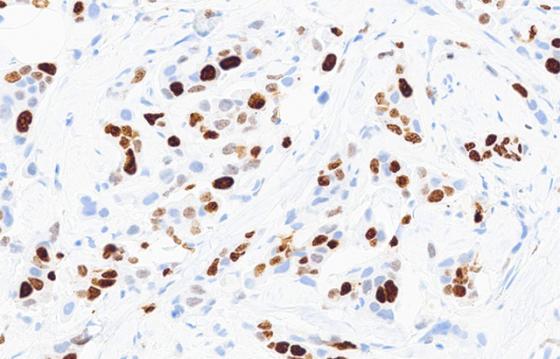 mindpeak_ki67_ruo_03_ihc_field_unannotated
