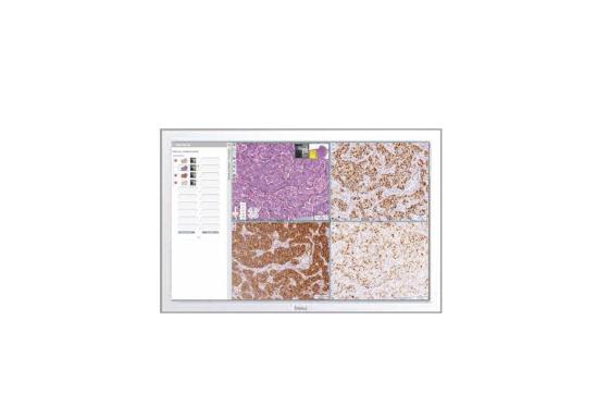 Aperio-eSlide-Manager-with-WebViewer-DX-2600x1733