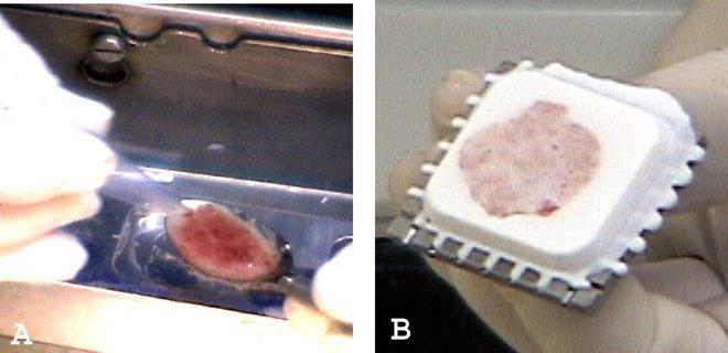 Figure 5. Liquid specimens easily embedded in these wells without crushing by a heat extractor. (A) Liquid tissues placed in the well using a spoon. (B) The embedded liquid forms a three-dimensional block which can be cut for frozen section while still preserving tissue for permanent sections. The specimen is prepared embedding medium.