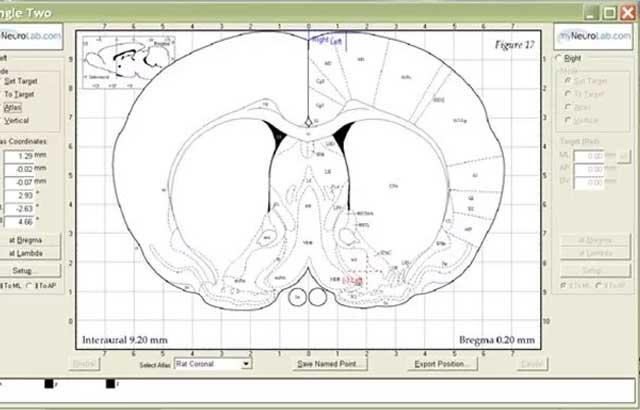 approach-angle-in-stereotaxic-surgery-640x410