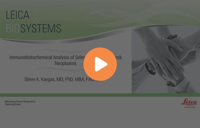 immunohistochemical-analysis-of-selected-head-and-neck-neoplasms-640x410