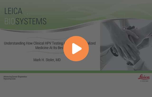 understanding-how-clinical-hpv-testing-leads-to-personalized-medicine-at-its-best-640x410