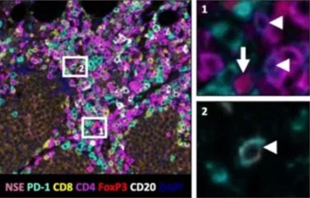 multiplexing-in-tissue-based-research-chromogenic-640x410