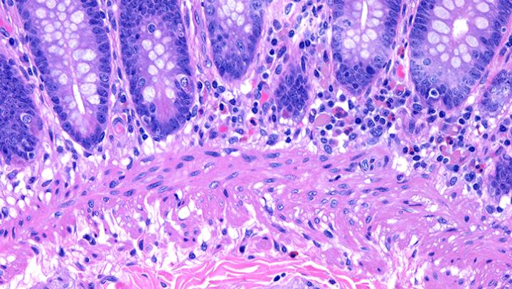 Glass-Coverslips-Provide-Superb-Optical-Clarity-for-Digital-Applications