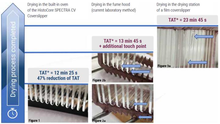 HistoCore-Spectra-CV-coverslipper-reduces-turnaround-time-by-47-from-glass-coverslipping-to-slide-drying-process-completion-fig-1