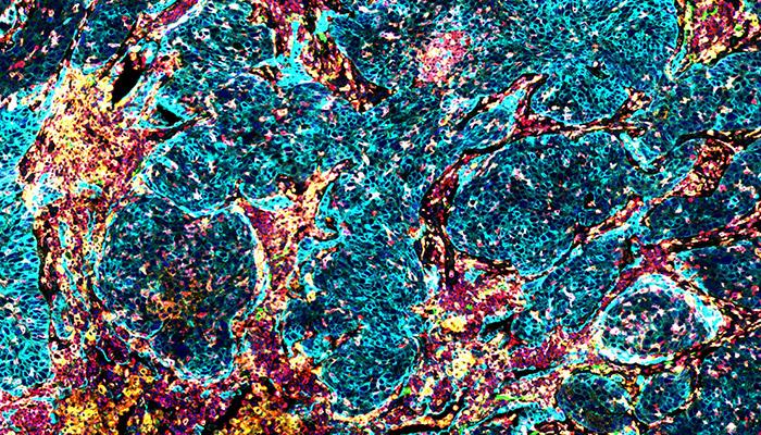 Macrophage-Polarization-Panel-700x400
