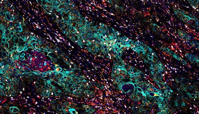 T-Cell-Exhaustion-Panel-700x400