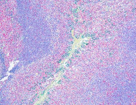 HCR_Pro_RNA_CISH_IHC_PD_L1_Partner_Page_Research_Application_1_450x350