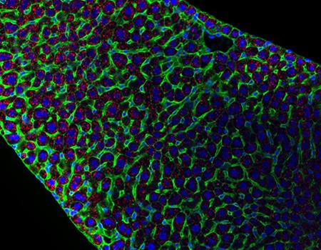 HCR_Pro_RNA_FISH_IF_Membrane_Stain_Partner_Page_Research_Application_2_450x350