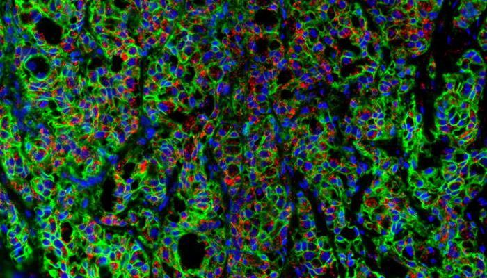 HCR_Pro_RNA_FISH_MembraneStain_OI-Partner-Card-700x400