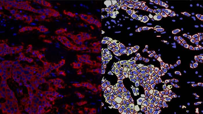 AI-Powered-Nuclear-and-Membrane-Segmentation