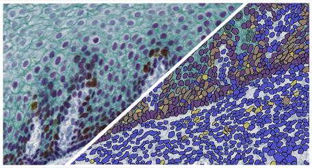 halo-Multiplex-IHC