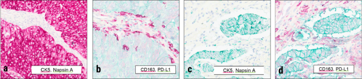 Figure 3 Chromoplex II Staining
