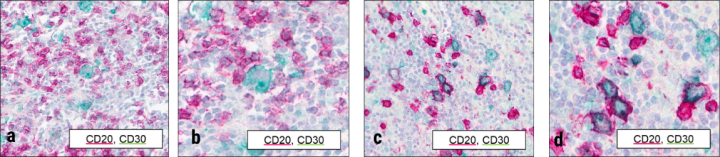 Figure 4 Duplex Staining
