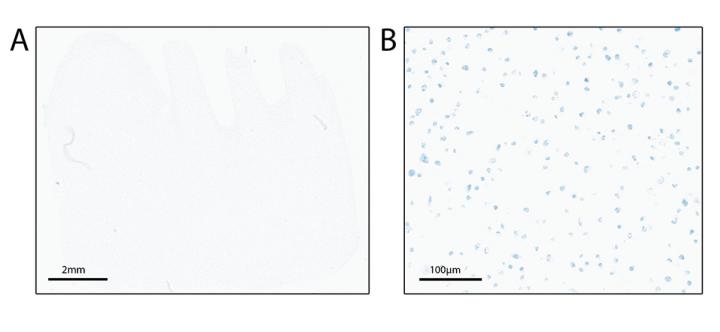 The Aperio GT 450 Manual Scanning feature is used for faint and sparsely cellular samples
