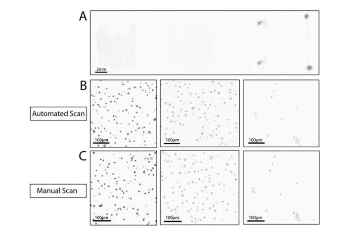 Aperio GT 450 manual scan feature for samples with prominent artifacts figure 4