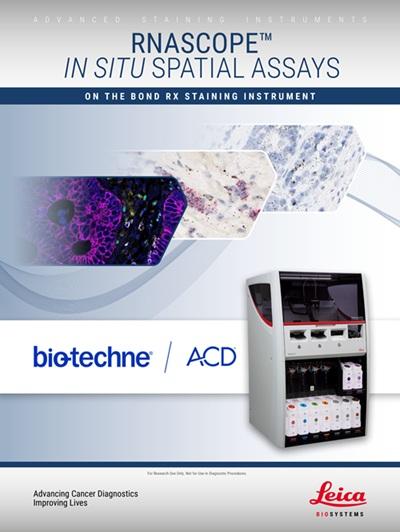 RNAscope-in-situ-spatial-assays