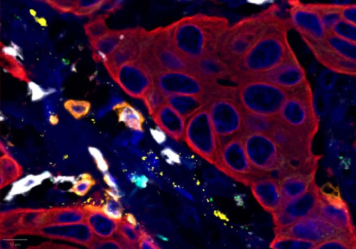Results - Experimental Multiomic Staining in Breast Cancer