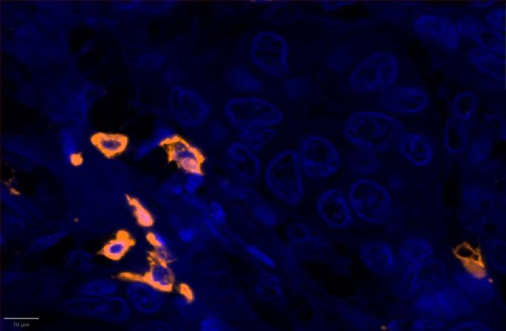 CD8 - Experimental Multiomic Staining in Breast Cancer