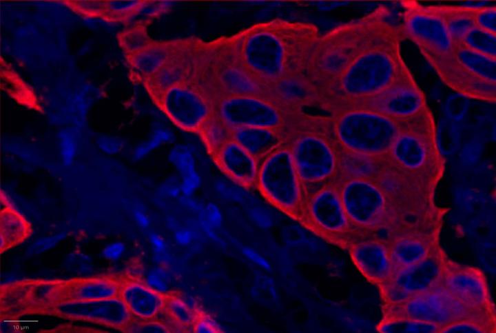 PanCK - Experimental Multiomic Staining in Breast Cancer